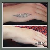 Tatau (Laser) Lounge