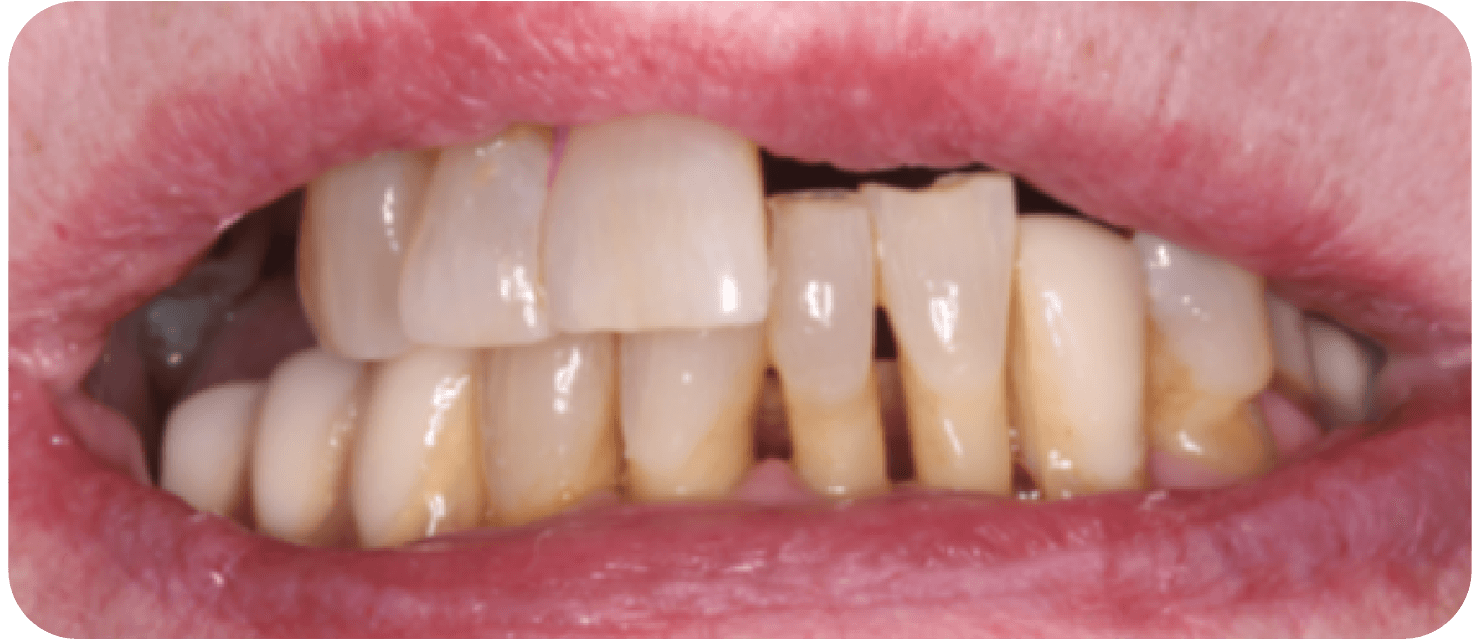 KENDAL DENTAL AESTHETIC AND IMPLANT CLINIC